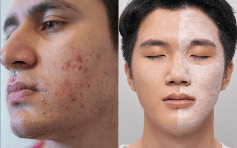 Men's Skincare
